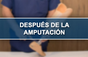Despus Amputacin