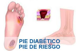 Pie Diabtico